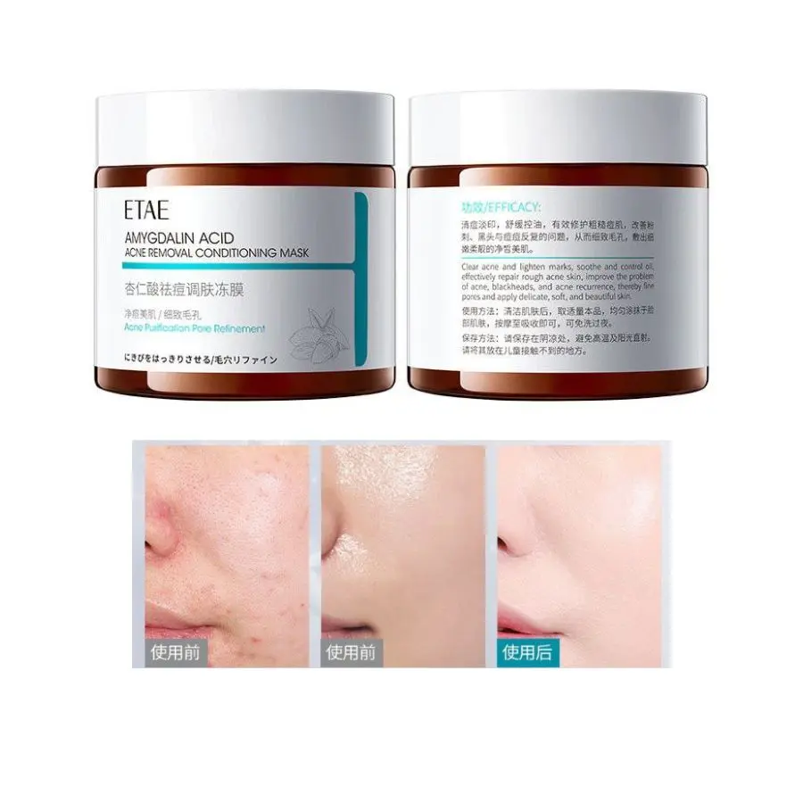 MASCARILLA ACONDICIONADORA ELIMINACIÓN DE ACNÉ 110G - ETAE FZ42767 - Imagen 2