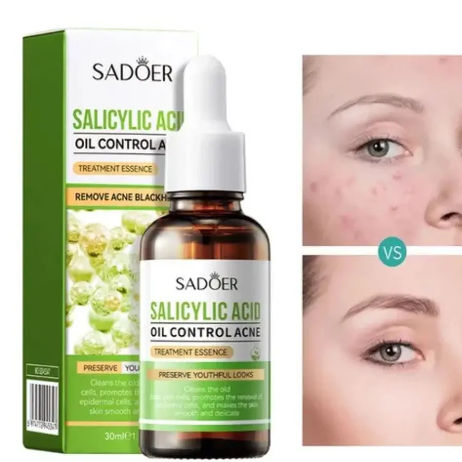 ACEITE DE ÁCIDO SALICÍLICO PARA CONTROLAR EL ACNÉ 30ML - SADOER