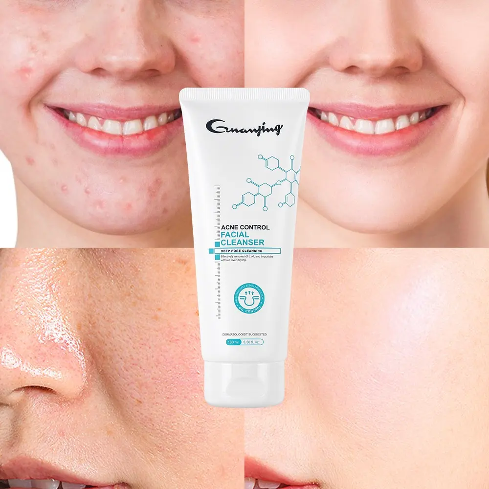 LIMPIADOR FACIAL PARA EL ACNÉ 100ML GJ6532 - GUANJING - Imagen 2